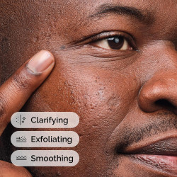 The Ordinary Solución de ácido salicílico al 2%, suero para combatir el acné