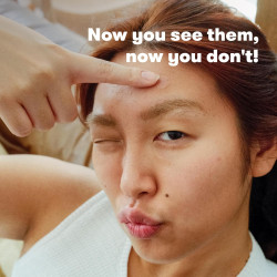 Proactiv Zits Happen Parches hidrocoloides para acné