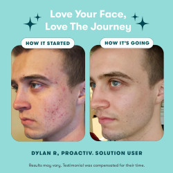 Proactiv Solution Sistema de tratamiento contra el acné en 3 pasos (Kit original para el acné de 60 días)
