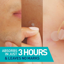 Parches hidrocoloides para imperfecciones CeraVe, control de imperfecciones con absorción de grasa