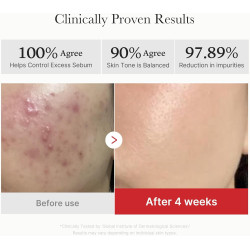 Almohadillas exfoliantes para pieles propensas a las imperfecciones con niacinamida