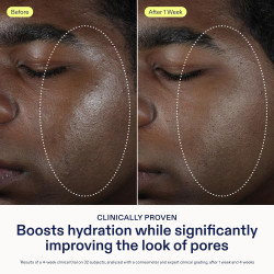 Crema hidratante ligera con ácido hialurónico y niacinamida + Piel grasa - Apta para el acné