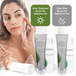 Tratamiento acné básico Exposed Skin Care