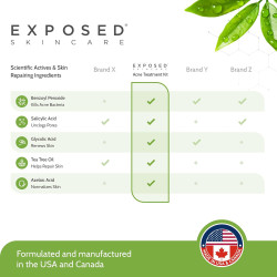 Tratamiento acné básico Exposed Skin Care
