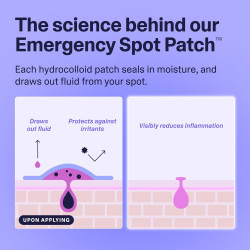 Parches de emergencia de espinillas para cara