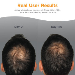 Viviscal - Suplementos para el crecimiento del cabello para mujer, con complejo de colágeno patentado