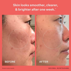 Peach & Lily - Suero de cristal para refinar la piel para la cara