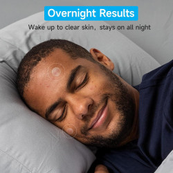 Parches de espinillas para la cara (504 unidades)