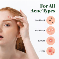 AOA Studio Cubierta absorbente curativa parche invisible para el acné