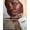 Remedio para espinillas - 36 parches de espinillas hidrocoloides de grado médico casi invisibles para manchas