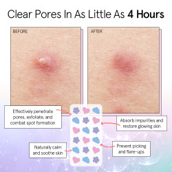 grace & stella Tiras para los poros galardonadas - Parches para granos faciales