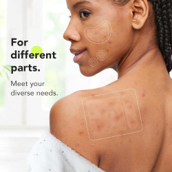 LitBear Parches grandes para espinillas (7 tamaños, 112 unidades)