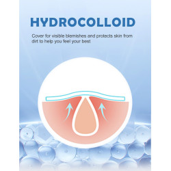 Parches de espinillas para cara, parches de acné hidrocoloide de estrellas