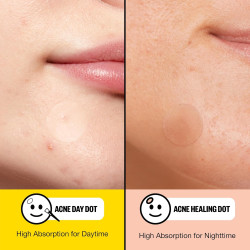 PEACE OUT Acne Day & Night Duo, parches hidrocoloides transparentes para granos para el día y la noche