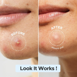 LitBear Parche de espinillas a granel