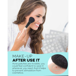 Parche para acné, 4 tamaños, 280 parches para absorber el acné