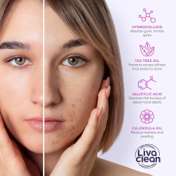 LivaClean 330 CT Parches para granos faciales con ácido salicílico