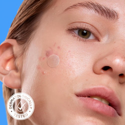 Parche para granos de acné (40 unidades) marca Avarelle