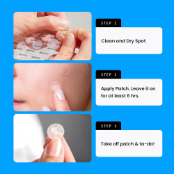 Parche para granos de acné (40 unidades) marca Avarelle