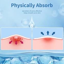 Parches de espinillas para cara, 3 tamaños, 510 parches hidrocoloides para para cubrir granos e imperfecciones